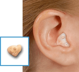 IMG-itc-and-ear-inset IMG-itc-and-ear-inset